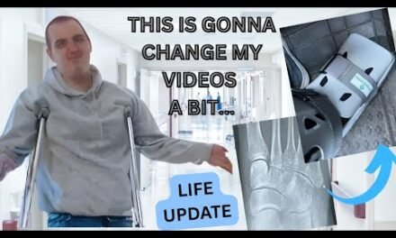THIS IS GONNA CHANGE MY VIDEOS A BIT…..LIFE UPDATE ~  I BROKE MY FOOT!