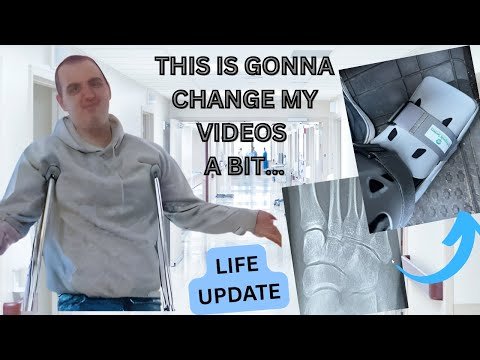 THIS IS GONNA CHANGE MY VIDEOS A BIT.....LIFE UPDATE ~ I BROKE MY FOOT!